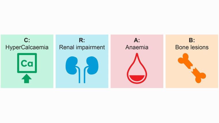 CRAB criteria for multiple myeloma investigation. C, hypercalcaemia; R, renal impairment; A, anaemia; B, bone lesions.